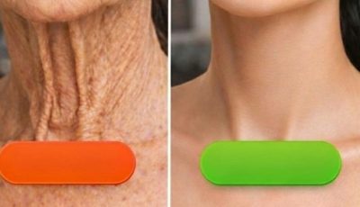 The Natural Method to Smooth Wrinkles and Dark Spots on Hands and Arms