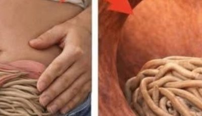 Garlic eliminates parasites in just 1 day? What you really should know before trying it