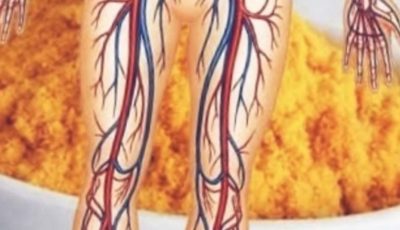 The Powerful Turmeric Remedy Everyone